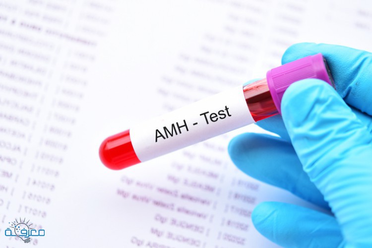 ما هو تحليل الخصوبة AMH