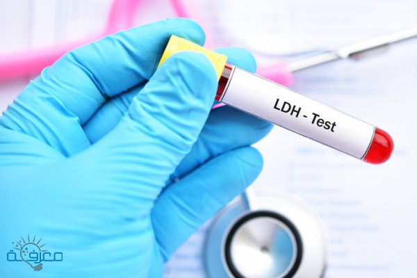 ما هو فحص LDH